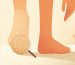 como quitar durezas de los pies